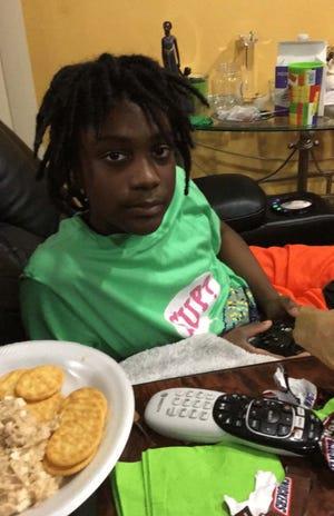 Amir Worship, 12, can be seen in 2019 after surgery.